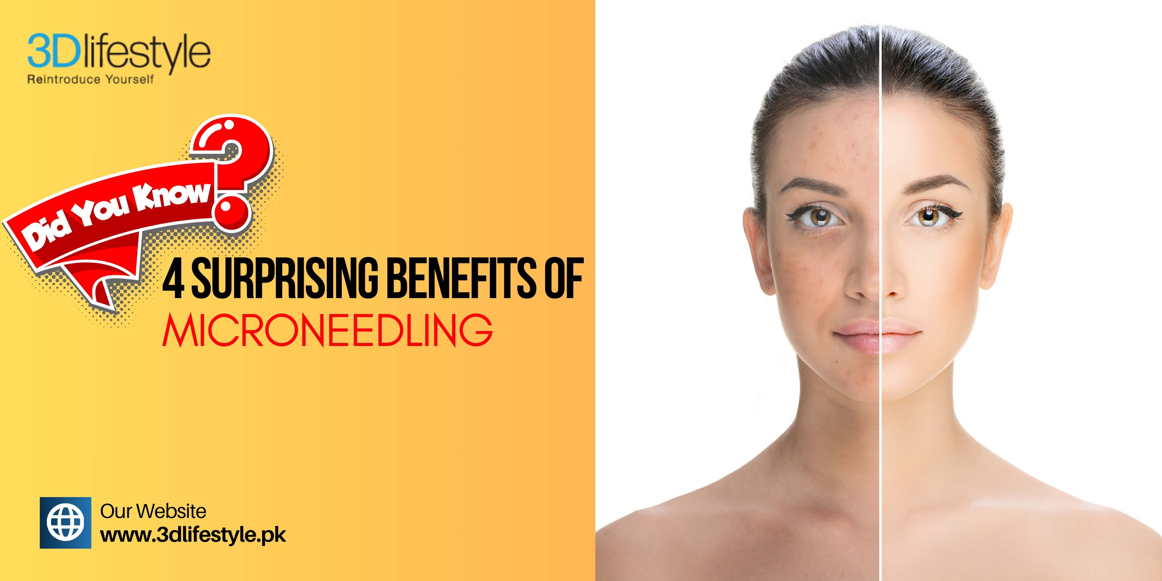 Benefits Of Microneedling