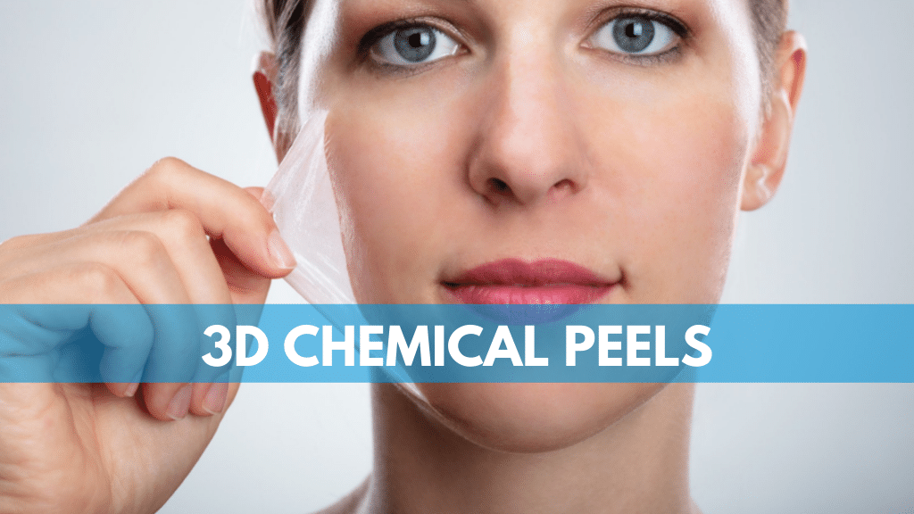3D Chemical Peels