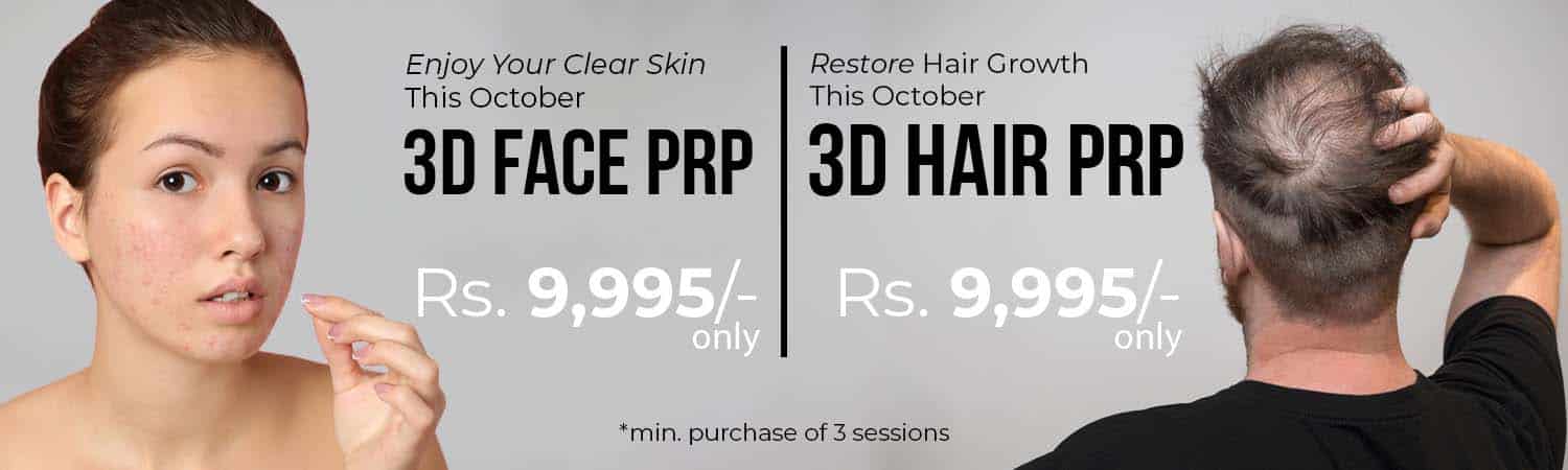 Hair and Face PRP - 3D Lifestyle Pakistan