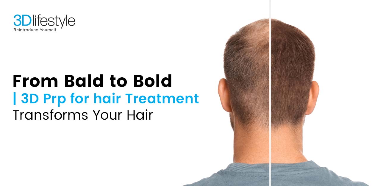 From Bald to Bold - 3D Prp for hair Treatment Transforms Your Hair - Copy