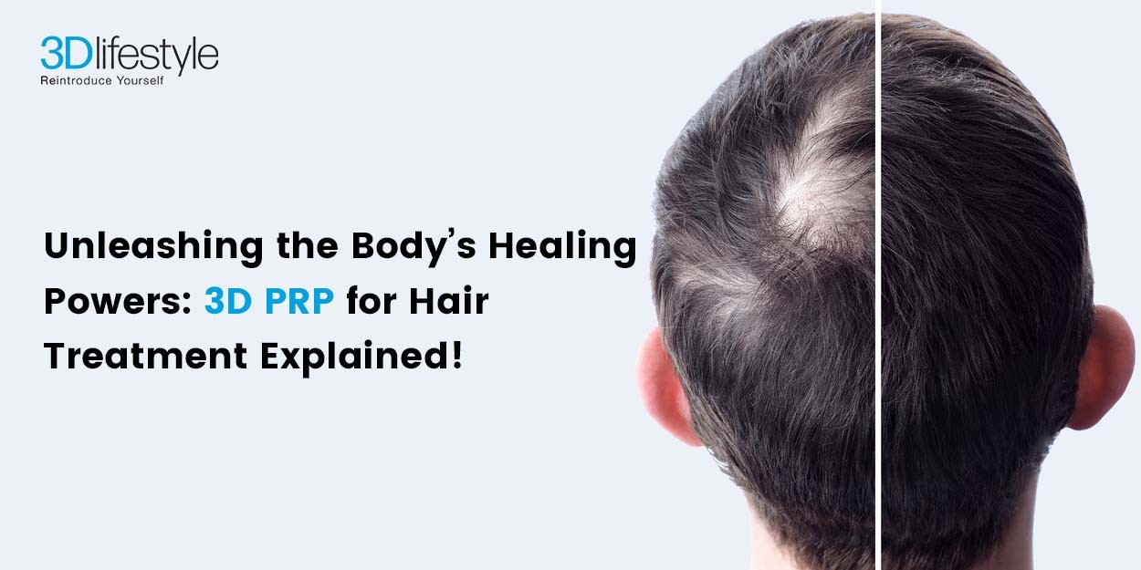 Unleashing the Body’s Healing Powers: 3D PRP for Hair Treatment Explained!