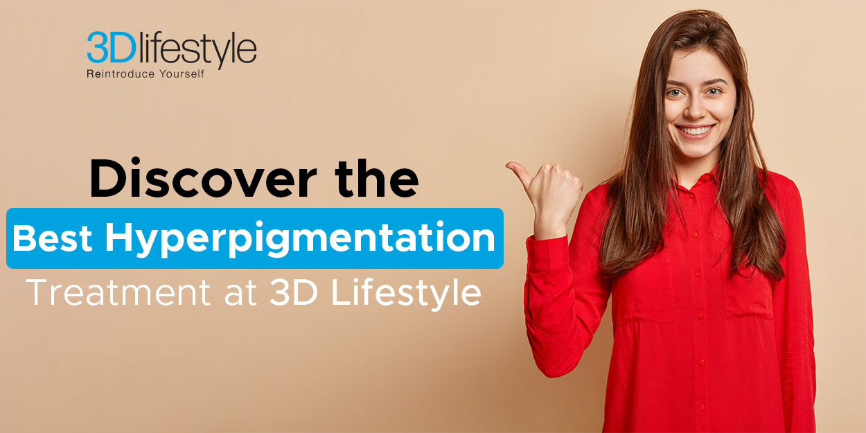 Discover the Best Hyperpigmentation Treatment at 3D Lifestyle