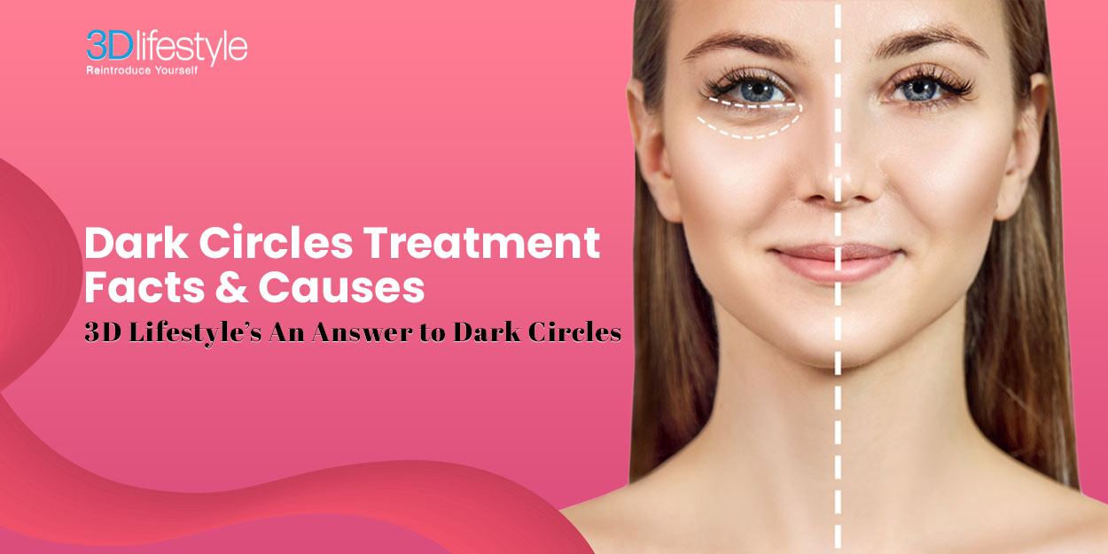 Dark Circles Treatment