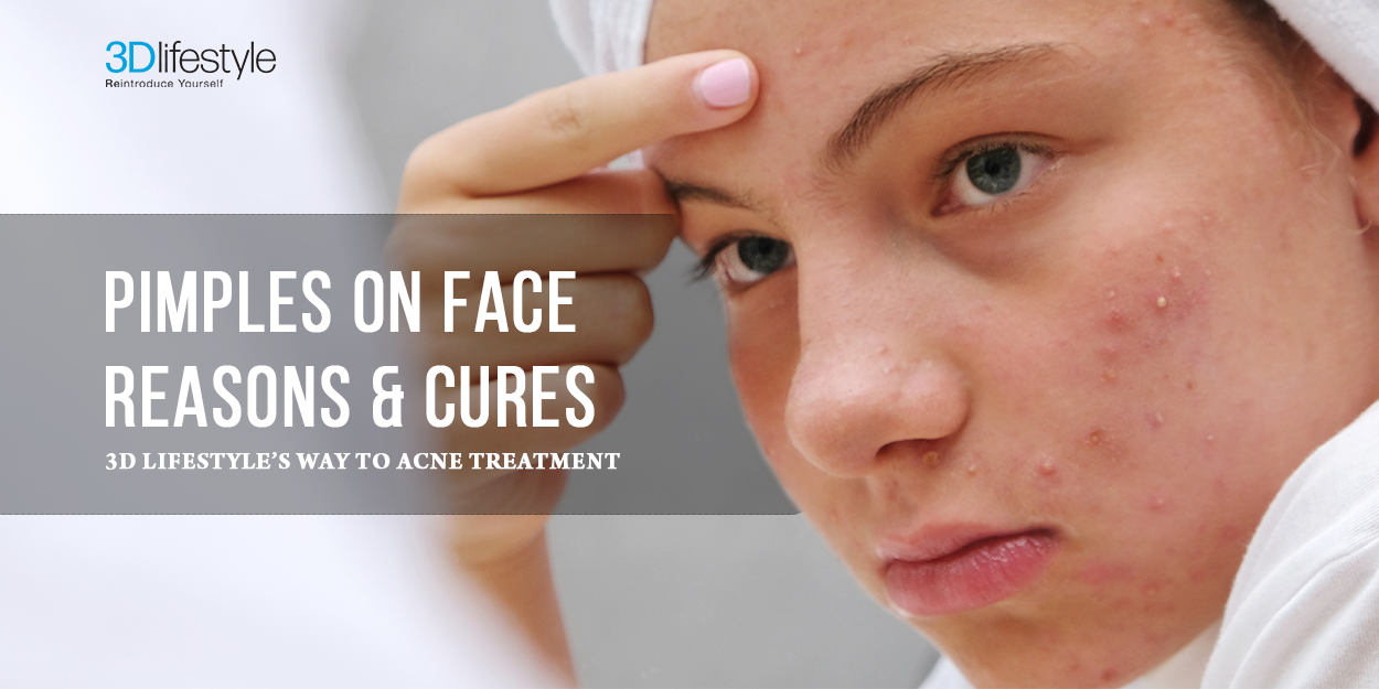 Pimples on Face Reasons