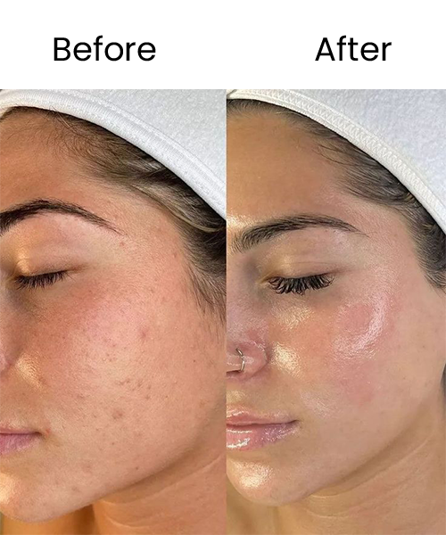 skin glowing before after