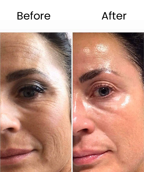 skin glowing before after