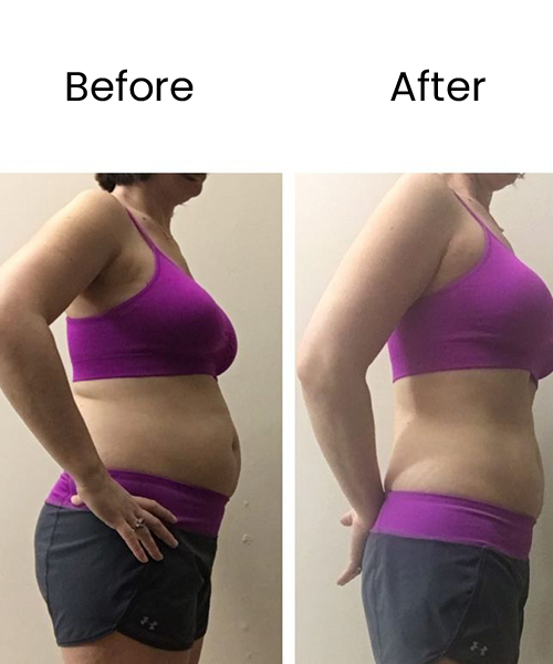 belly before after