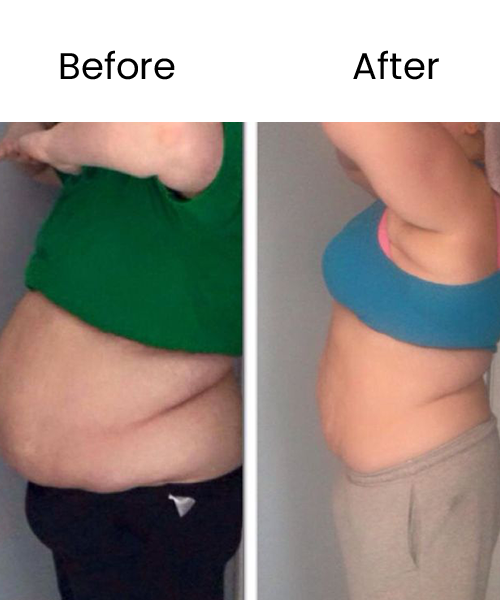 belly before after