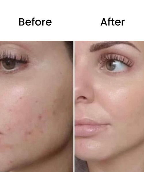 before after bb glow