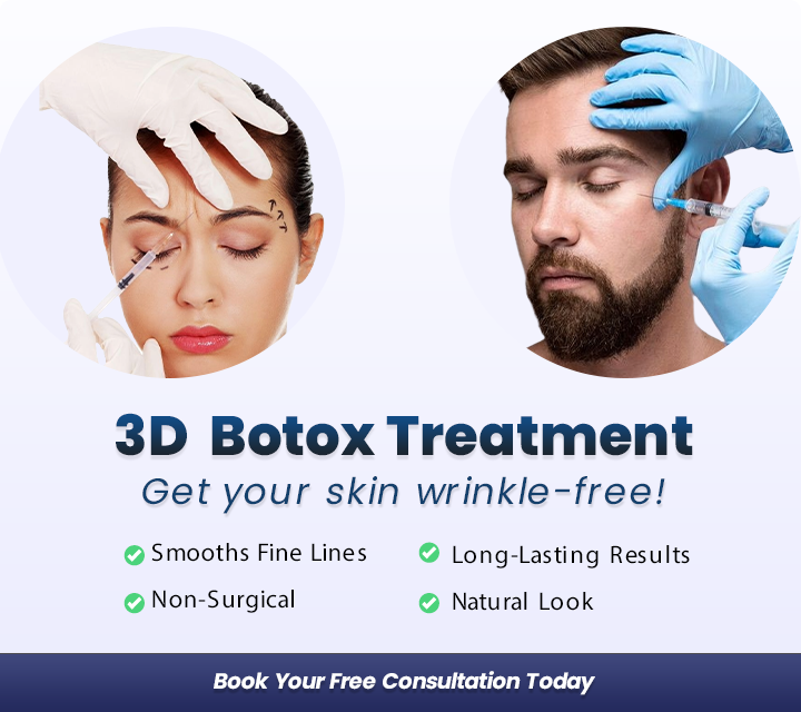 botox treatemnt