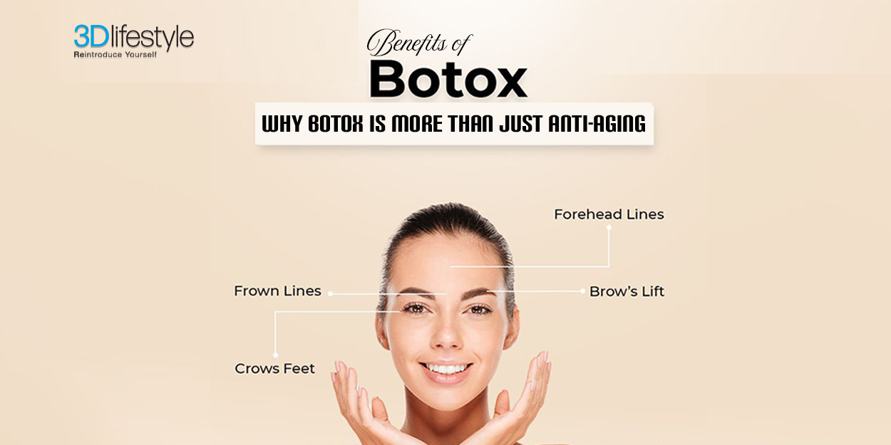 Benefits of Botox