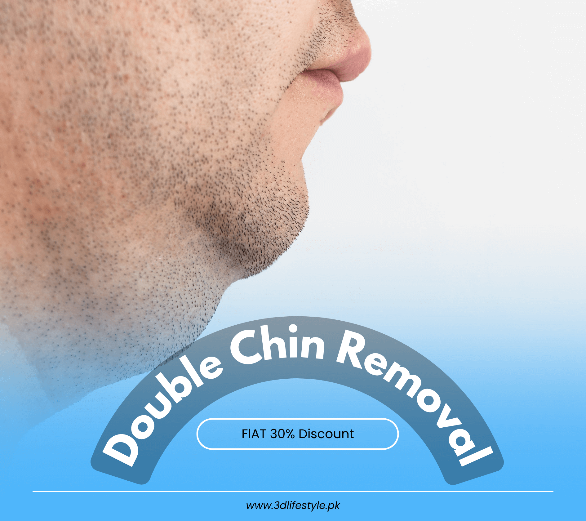 double-chin-removal