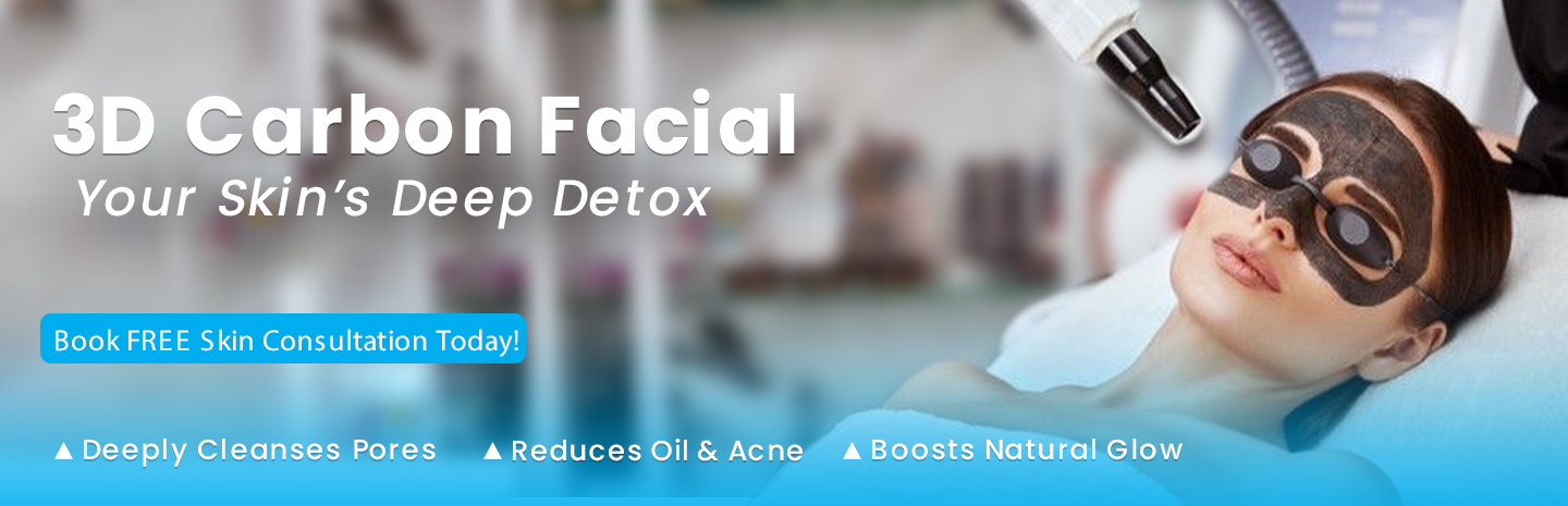 laser Carbon Facial