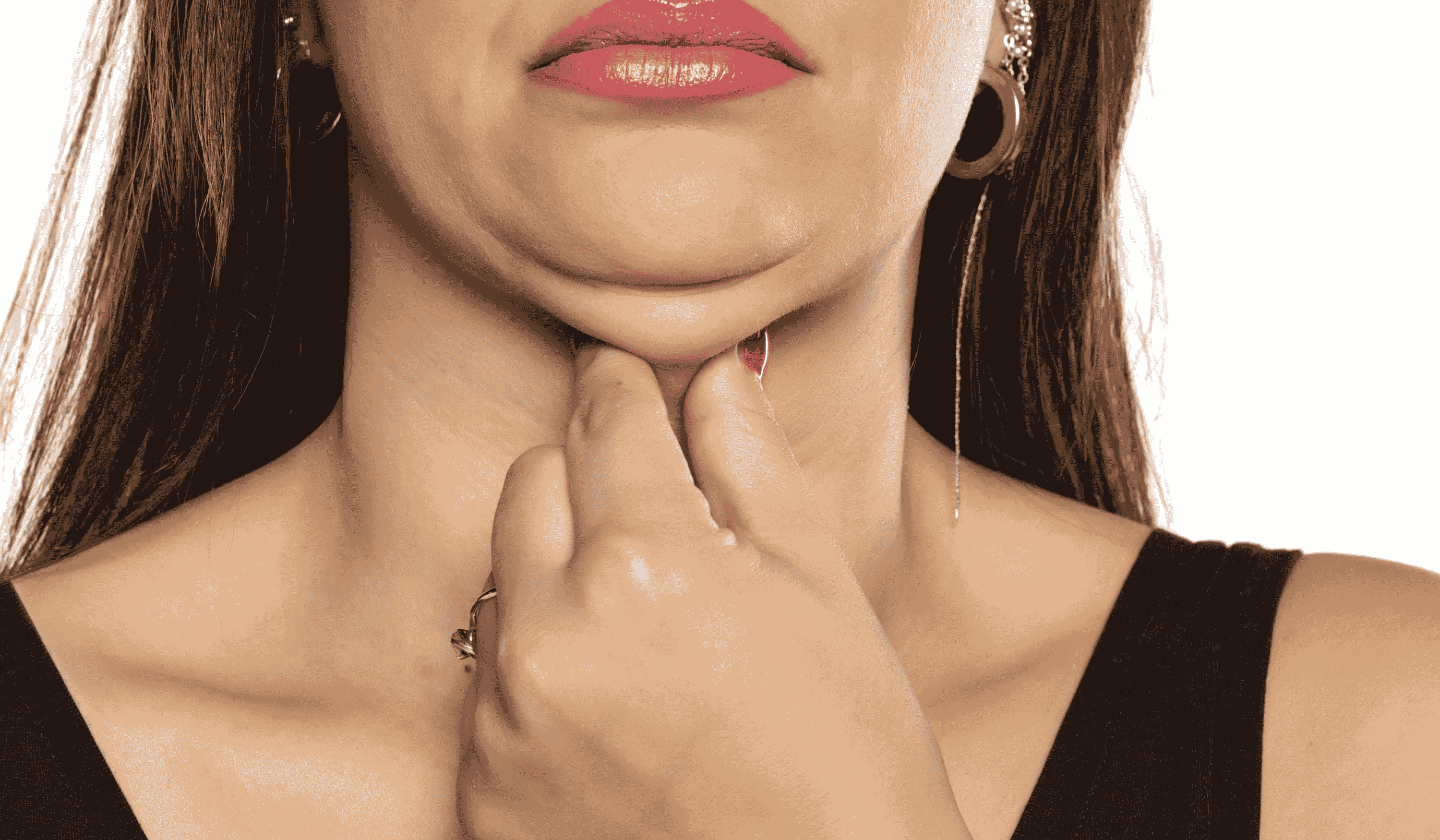 double chin removal