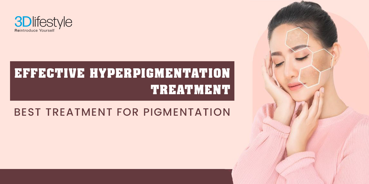 Effective Hyperpigmentation Treatment banner