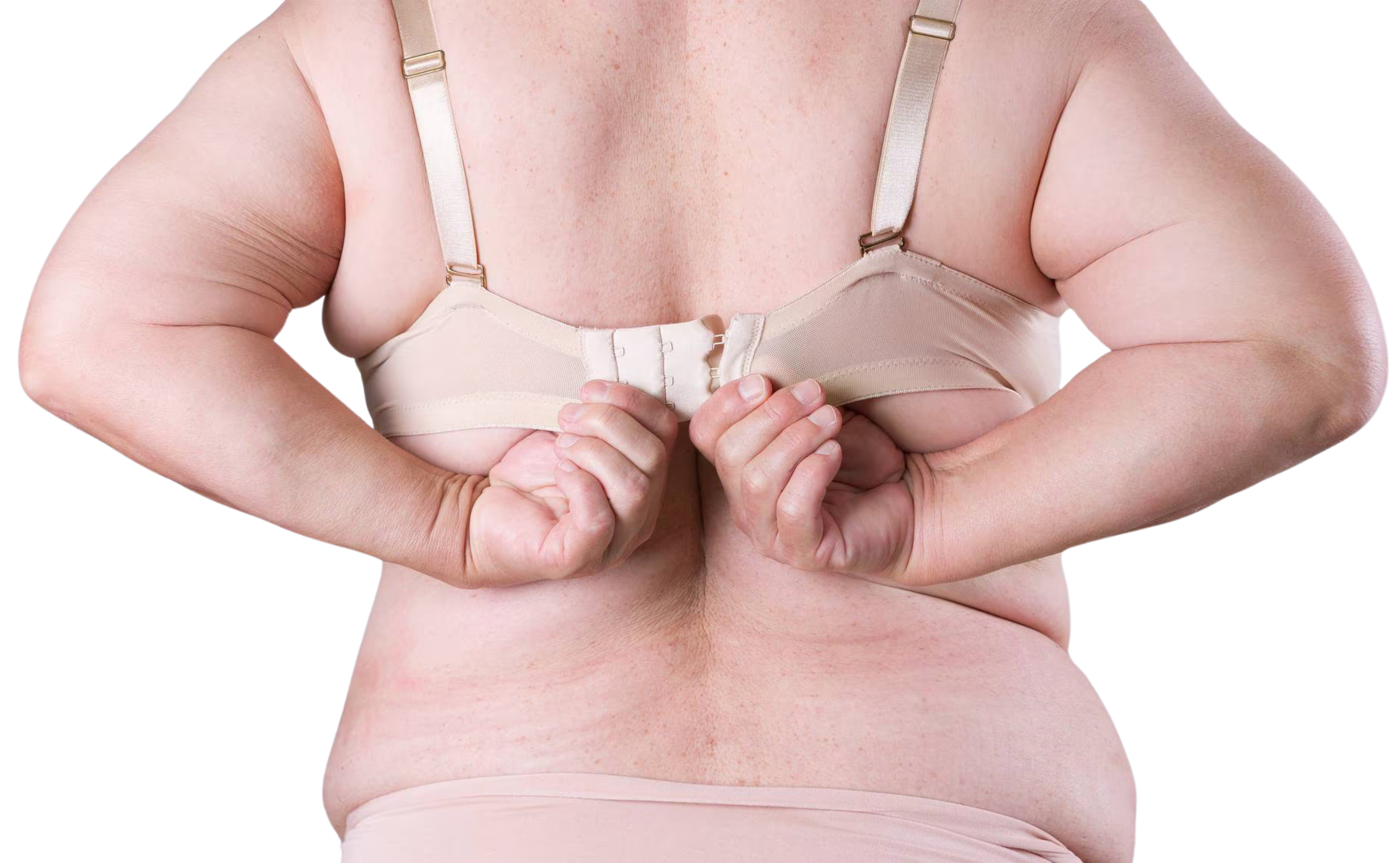 female bra fat removal