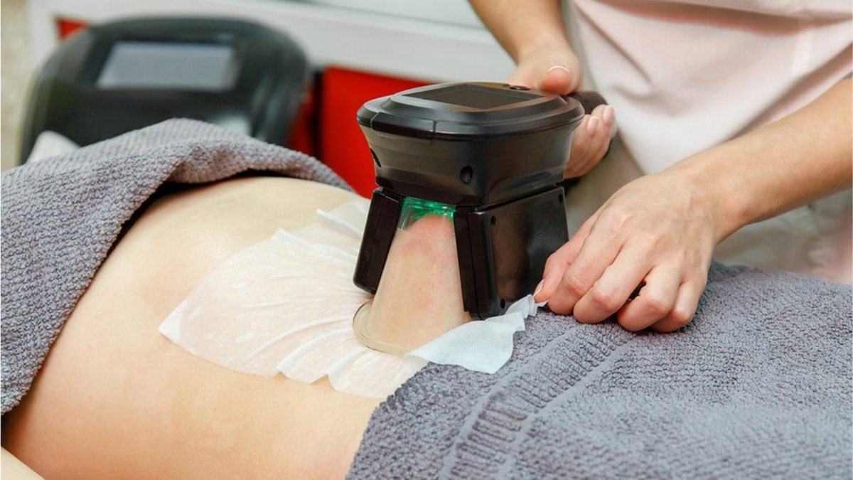 non Surgical Fat Reduction