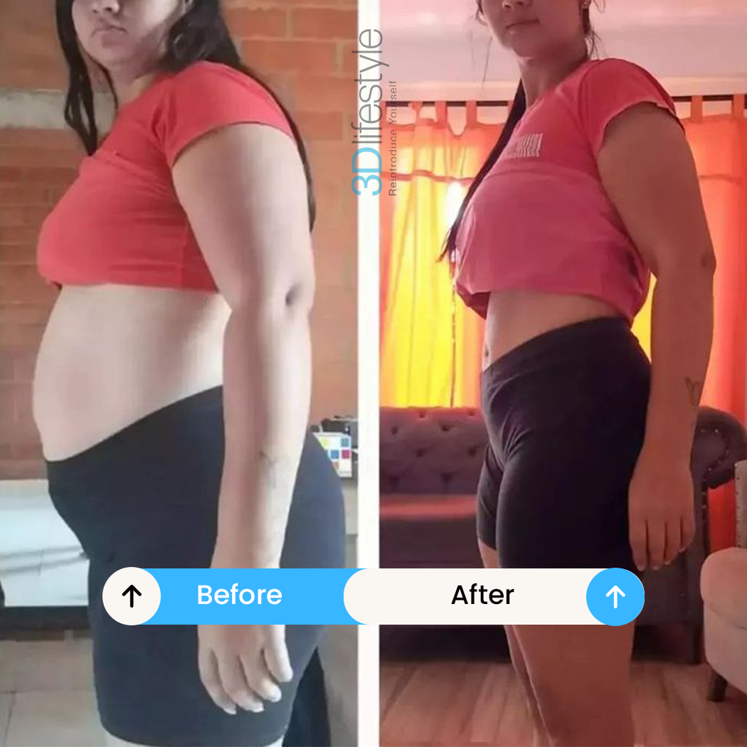 Body Contouring before .after.....