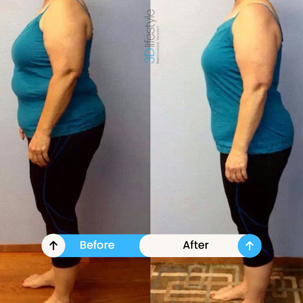 How to Lose Weight in 7 Days BEFORE .AFTER......