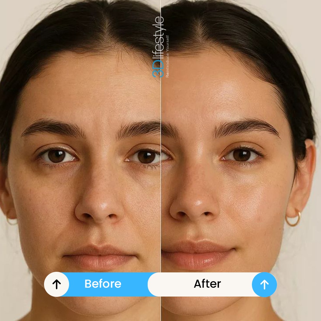 Winter Skin Care Routine